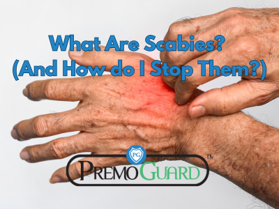 What Are Scabies? (And How Do I Stop Them?)