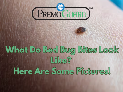 What Do Bed Bug Bites Look Like? Here Are Some Pictures!